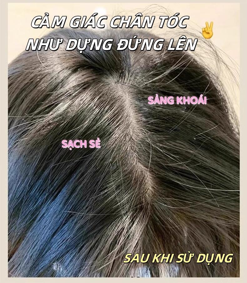 硅胶洗发刷 洗头刷 头皮按摩刷 高档柔软 轻柔按摩 适合所有头皮类型 厚发薄发均可使用 易清洁