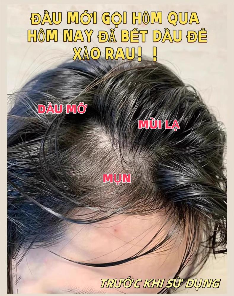 硅胶洗发刷 洗头刷 头皮按摩刷 高档柔软 轻柔按摩 适合所有头皮类型 厚发薄发均可使用 易清洁