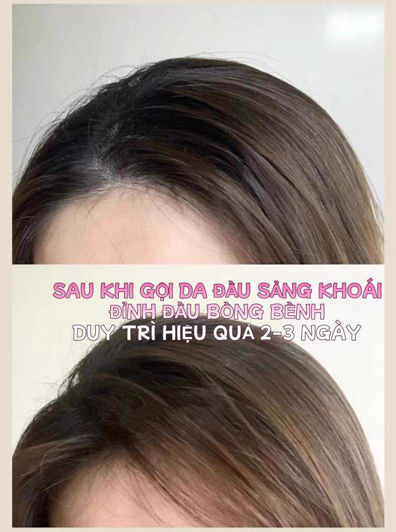 硅胶洗发刷 洗头刷 头皮按摩刷 高档柔软 轻柔按摩 适合所有头皮类型 厚发薄发均可使用 易清洁